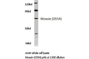 Western blot (WB) analysis of Moesin antibody in extracts from A549 cells. (Moesin antibody)