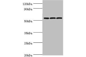 Western blot All lanes: Alpha-amylase 2B antibody at 8 μg/mL Lane 1: Mouse skeletal muscle tissue Lane 2: HL60 whole cell lysate Lane 3: K562 whole cell lysate Secondary Goat polyclonal to rabbit IgG at 1/10000 dilution Predicted band size: 58, 43 kDa Observed band size: 58 kDa (AMY2B antibody  (AA 16-320))