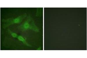 Immunofluorescence analysis of HeLa cells, using PKC zeta (Phospho-Thr410) Antibody. (PKC zeta antibody  (pThr410))