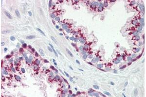Human Prostate (formalin-fixed, paraffin-embedded) stained with Heat Shock Protein 70 (HSP70) antibody ABIN364327 at 10 ug/ml followed by biotinylated anti-mouse IgG secondary antibody ABIN481714, alkaline phosphatase-streptavidin and chromogen. (HSP70 antibody  (AA 1-641))