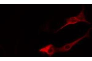 ABIN6274816 staining LOVO cells by IF/ICC. (ARF4 antibody  (Internal Region))