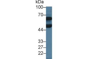Western Blot; Sample: Porcine Cerebrum lysate; Primary Ab: 3µg/ml Rabbit Anti-Human DBR1 Antibody Second Ab: 0. (DBR1 antibody  (AA 243-372))
