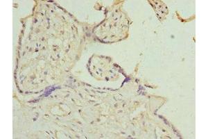 Immunohistochemistry of paraffin-embedded human placenta tissue using ABIN7156942 at dilution of 1:100 (IL9 Receptor antibody  (AA 272-521))