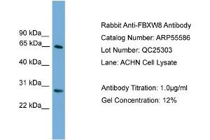 WB Suggested Anti-FBXW8  Antibody Titration: 0. (FBXW8 antibody  (Middle Region))