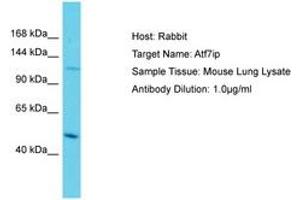 Image no. 1 for anti-Activating Transcription Factor 7 Interacting Protein (ATF7IP) (AA 553-602) antibody (ABIN6750272)