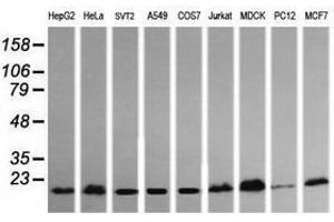 Image no. 1 for anti-HRas proto-oncogene, GTPase (HRAS) antibody (ABIN1498715) (HRAS antibody)