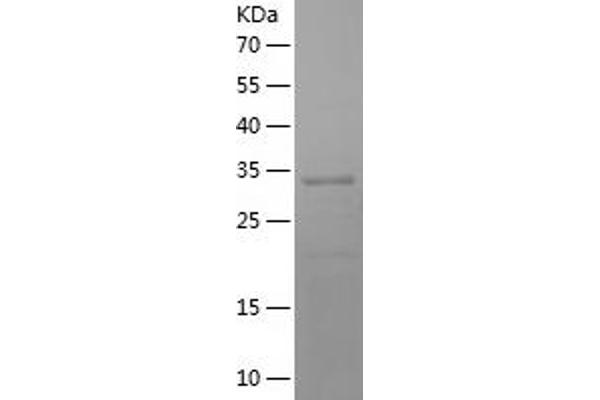 WT1 Protein (AA 157-445) (His tag)