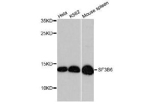 Western blot analysis of extracts of various cell lines, using SF3B6 antibody. (Pre-mRNA Branch Site Protein p14 (SF3B14) (AA 1-125) antibody)