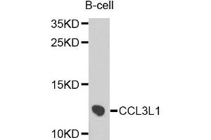 Western blot analysis of extracts of B cells, using CCL3L1 antibody. (CCL3L1 antibody)