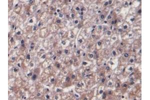 Immunohistochemistry (IHC) image for anti-Prothrombin Fragment 1+2 (F1+2) antibody (ABIN7428374)