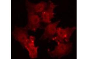 ABIN6266964 staining Hela by IF/ICC. (TPD52L2 antibody  (C-Term))