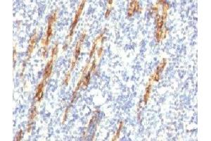 Formalin-fixed, paraffin-embedded human tonsil stained with CD34 antibody (QBEnd/10 + HPCA1/763) (CD34 antibody)