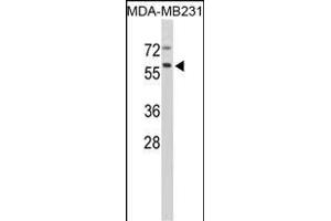Western blot analysis of CTSF Antibody (Center ) (ABIN390488 and ABIN2840848) in MDA-M cell line lysates (35 μg/lane). (Cathepsin F antibody  (AA 261-290))