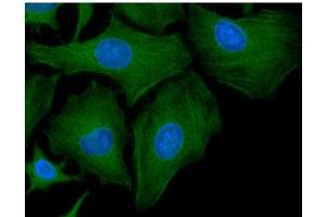 ICC/IF analysis of GCLM in HeLa cells line, stained with DAPI (Blue) for nucleus staining and monoclonal anti-human GCLM antibody (1:100) with goat anti-mouse IgG-Alexa fluor 488 conjugate (Green). (GCLM antibody  (AA 1-274))