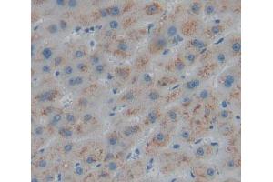 Used in DAB staining on fromalin fixed paraffin- embedded liver tissue (ABAT antibody  (AA 249-500))