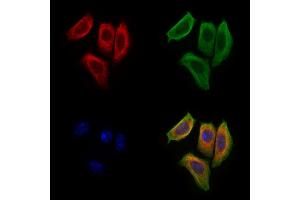 ABIN6265207 and ABIN6277244 staining Hela cells by IF/ICC. (SNCG antibody  (C-Term))