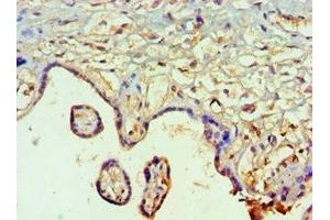 Immunohistochemistry of paraffin-embedded human placenta tissue using ABIN7160250 at dilution of 1:100 (SMAD9 antibody  (AA 1-300))