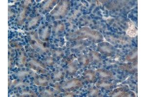 Detection of MMP12 in Mouse Kidney Tissue using Polyclonal Antibody to Matrix Metalloproteinase 12 (MMP12) (MMP12 antibody  (AA 294-473))