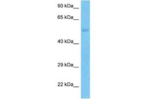 Host:  Rabbit  Target Name:  SLC43A3  Sample Type:  Jurkat Whole Cell lysates  Antibody Dilution:  1. (SLC43A3 antibody  (N-Term))