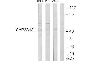 Western Blotting (WB) image for anti-Cytochrome P450, Family 2, Subfamily A, Polypeptide 13 (CYP2A13) (Internal Region) antibody (ABIN5977214) (CYP2A13 antibody  (Internal Region))