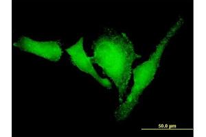 Immunofluorescence of purified MaxPab antibody to VASP on HeLa cell. (VASP antibody  (AA 1-380))