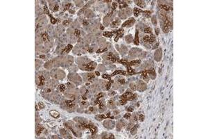 Immunohistochemical staining of human pancreas with SMAP2 polyclonal antibody  shows strong cytoplasmic positivity in pancreatic ducts.