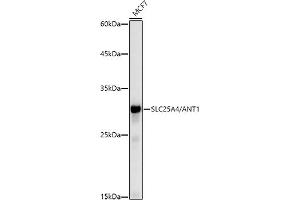 Western blot analysis of extracts of MCF7 cells, using SLC25/ antibody (ABIN7270428) at 1:1000 dilution.