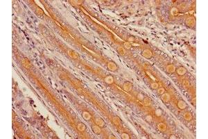 Immunohistochemistry of paraffin-embedded human small intestine tissue using ABIN7149259 at dilution of 1:100 (CYP3A4 antibody  (AA 259-441))