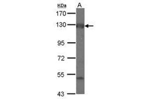Image no. 1 for anti-Adenylate Cyclase 2 (Brain) (ADCY2) (C-Term) antibody (ABIN1491734) (ADCY2 antibody  (C-Term))