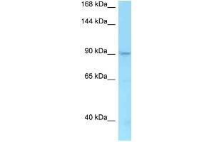 WB Suggested Anti-TMEM63A Antibody   Titration: 1. (TMEM63A antibody  (C-Term))