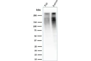 Western Blot Analysis of Raji and Ramos cell lysate using Ki67 Mouse Monoclonal Antibody (MKI67/2461).
