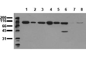 Western Blotting (WB) image for anti-Catenin (Cadherin-Associated Protein), beta 1, 88kDa (CTNNB1) (Exon 3) antibody (ABIN126747) (CTNNB1 antibody  (Exon 3))
