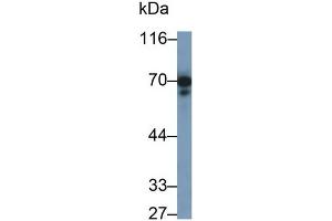 Detection of PTPRO in Rat Cerebrum lysate using Polyclonal Antibody to Protein Tyrosine Phosphatase Receptor Type O (PTPRO) (PTPRO antibody  (AA 948-1205))