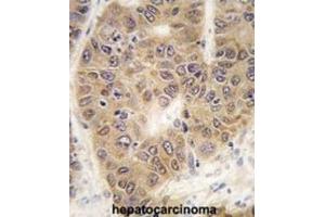 Immunohistochemistry (IHC) image for anti-Small Ubiquitin Related Modifier 4 (SUMO4) (Met55Val-Mutant) antibody (ABIN2996873) (SUMO4 antibody  (Met55Val-Mutant))