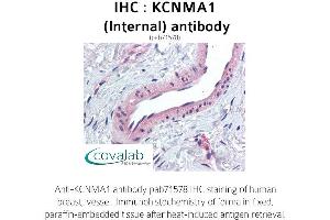 Image no. 1 for anti-Potassium Large Conductance Calcium-Activated Channel, Subfamily M, alpha Member 1 (KCNMA1) (Internal Region) antibody (ABIN1736190) (KCNMA1 antibody  (Internal Region))