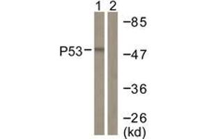 Western blot analysis of extracts from COS7 cells, treated with TSA 400nM 24h, using p53 (Ab-382) Antibody. (p53 antibody  (AA 344-393))