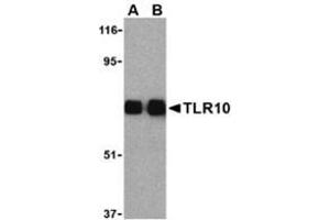 Western blot analysis of TLR10 in human lymph node cell lysates with this product at (A) 0. (TLR10 antibody  (Center))
