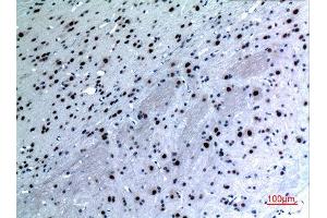 Immunohistochemistry (IHC) analysis of paraffin-embedded Rat Brain, antibody was diluted at 1:100. (KRT14 antibody  (C-Term))