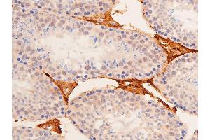 Immunohistochemistry (IHC) image for anti-Tumor Protein P53 (TP53) (pSer392) antibody (ABIN6256312)