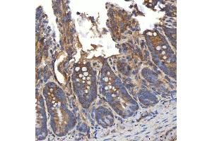 IHC analysis of SLC20A1 using anti-SLC20A1 antibody (ABIN7602463).