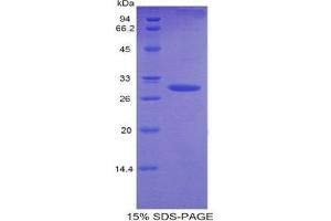 SDS-PAGE (SDS) image for Plastin 3 (PLS3) (AA 5-251) protein (His tag) (ABIN2121908)