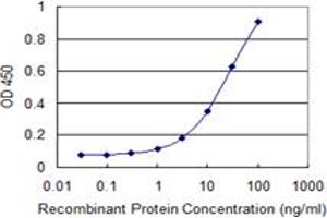 Detection limit for recombinant GST tagged CDYL is 0. (CDYL antibody  (AA 153-260))
