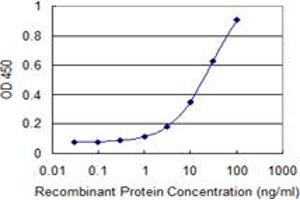 Detection limit for recombinant GST tagged CDYL is 0.