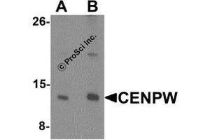 Western Blotting (WB) image for anti-Centromere Protein W (CENPW) (N-Term) antibody (ABIN1587944) (CENPW antibody  (N-Term))