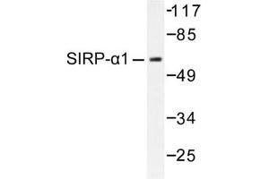 Image no. 1 for anti-Signal-Regulatory Protein alpha (SIRPA) antibody (ABIN271815) (SIRPA antibody)
