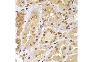 Immunohistochemistry of paraffin-embedded human kidney using PHF21B antibody at dilution of 1:100 (40x lens). (PHF21B antibody)