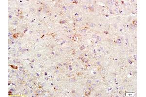 Formalin-fixed and paraffin embedded rat brain labeled with Anti KSR1 Polyclonal Antibody, Unconjugated (ABIN700645) at 1:200 followed by conjugation to the secondary antibody and DAB staining