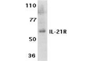 Western blot analysis of IL-21 receptor expression in human Raji cell lysate with AP30414PU-N IL-21 Receptor antibody at 1 μg /ml.