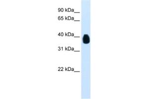 Western Blotting (WB) image for anti-Ets Variant 7 (ETV7) antibody (ABIN2461239)