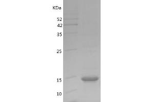 Western Blotting (WB) image for Glycogen Synthase Kinase 3 beta (GSK3b) (AA 2-66) protein (His tag) (ABIN7281778) (GSK3 beta Protein (AA 2-66) (His tag))